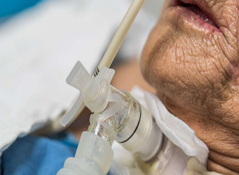 Tracheostomy Tube Change at Home in Mayur Vihar, Delhi